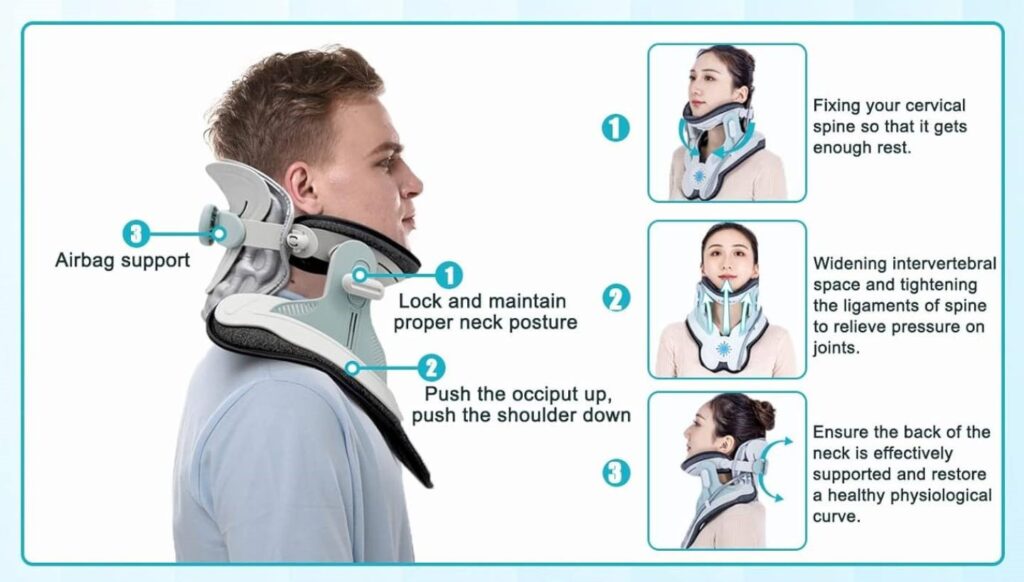 What is a Halo Neck Brace