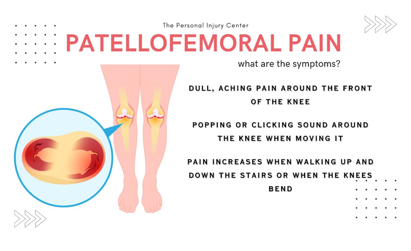 Patellofemoral Pain 
